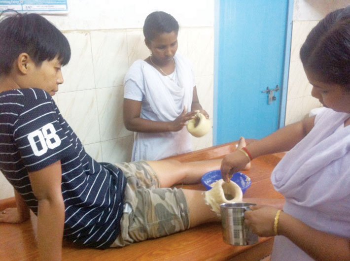 Bijeta Devi, a footballer from Manipur, undergoes therapy at a Thrissur ayurveda hospital